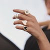 Anillo ICU